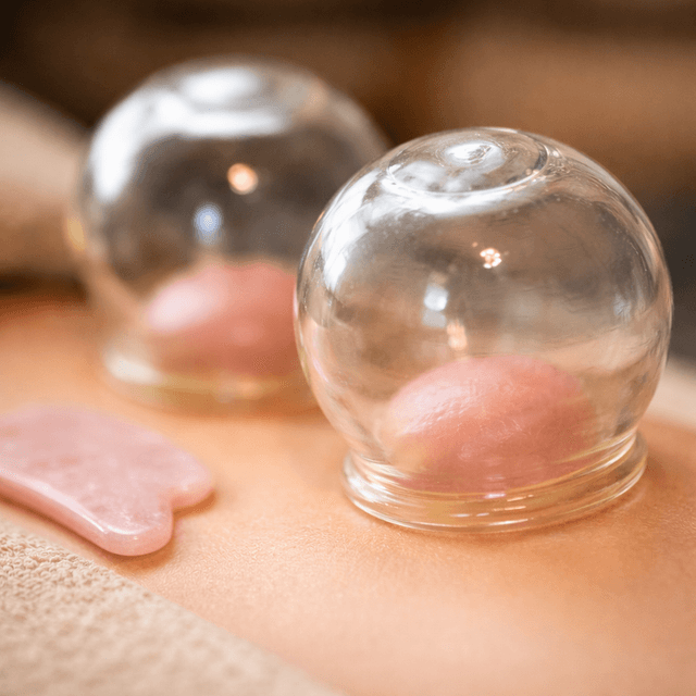 Cupping Therapy